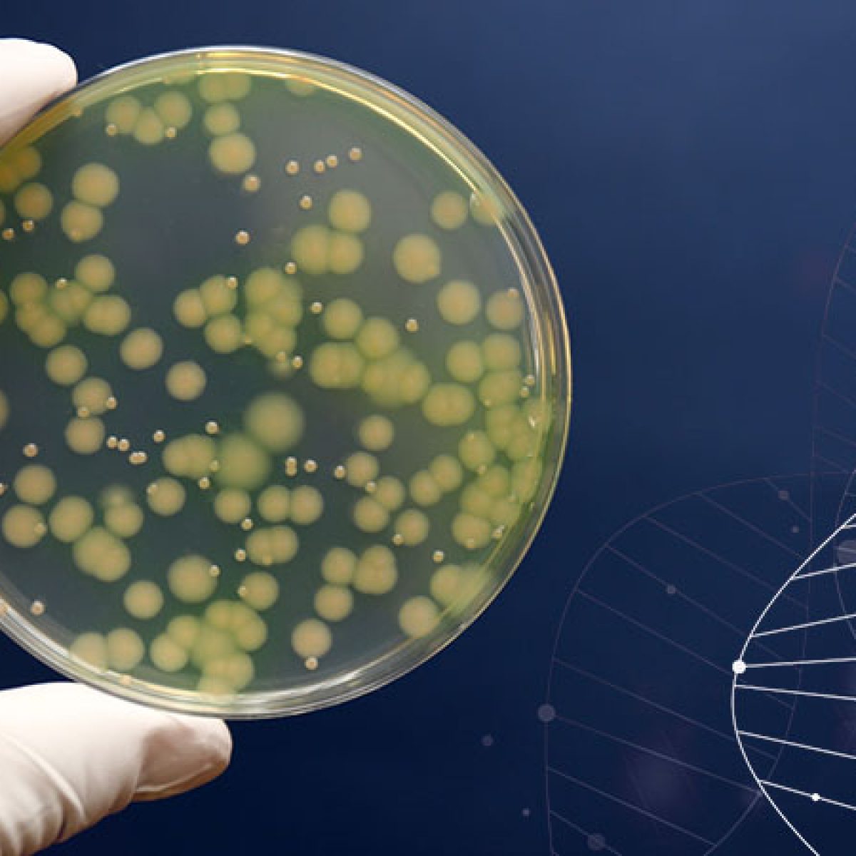 細菌の鑑別 緑膿菌 Pseudomonas aeruginosa 細菌の鑑別 緑膿菌 Pseudomonas aeruginosa